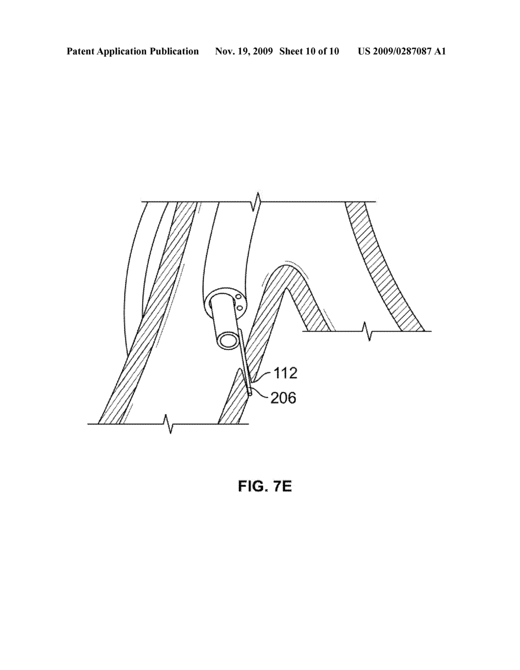 DEVICES FOR CREATING PASSAGES AND SENSING FOR BLOOD VESSELS - diagram, schematic, and image 11