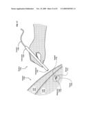 Circulatory monitoring systems and methods diagram and image