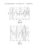 ISCHEMIA DETECTION USING A HEART SOUND SENSOR diagram and image