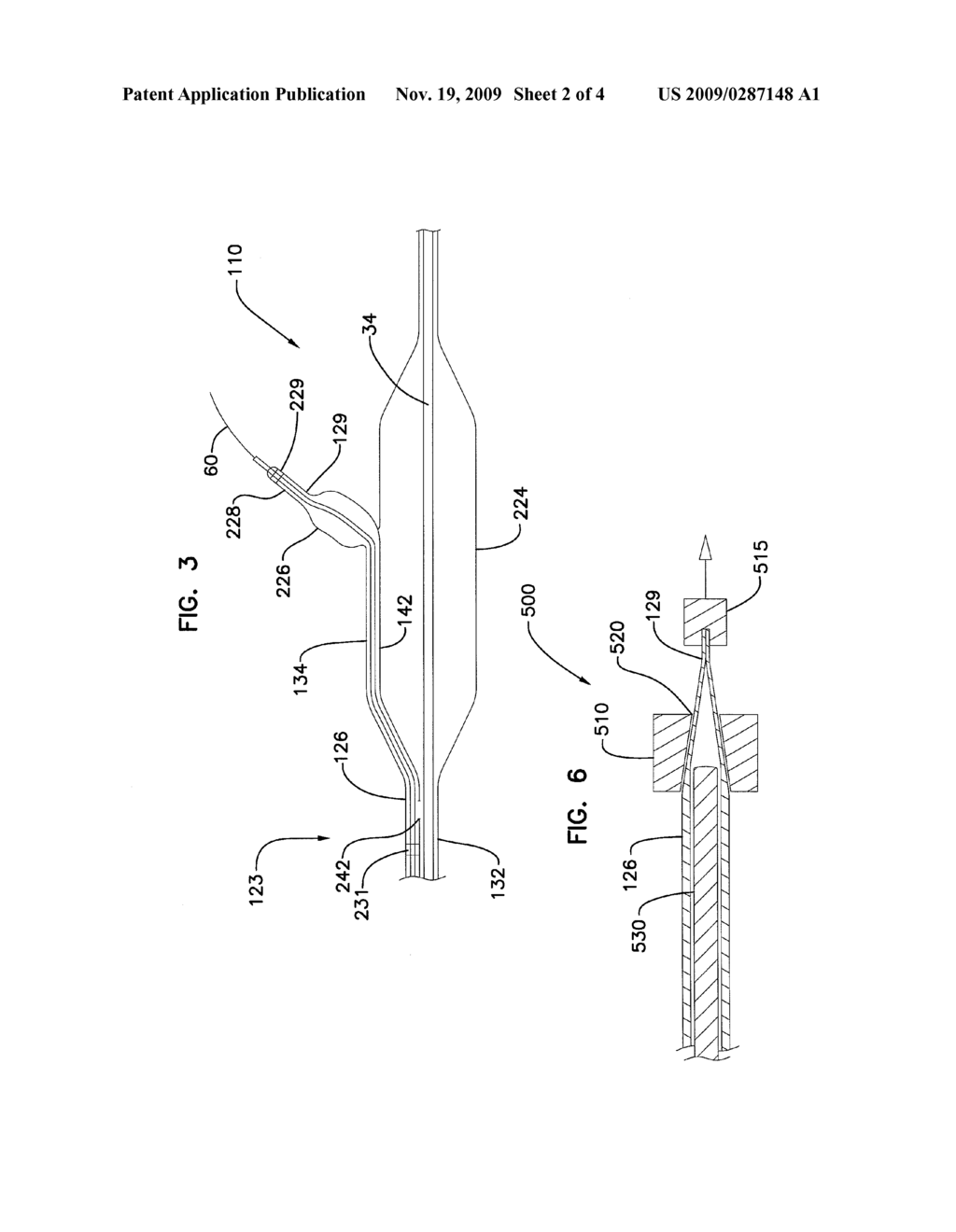 Joined Inflation Portions for Bifurcation Catheter - diagram, schematic, and image 03