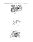 Implant for long bones and treatment method diagram and image