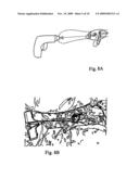 Implant for long bones and treatment method diagram and image