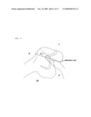 Method and system for cutting knee joint using robot diagram and image