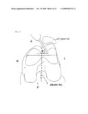 Method and system for cutting knee joint using robot diagram and image