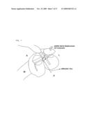 Method and system for cutting knee joint using robot diagram and image