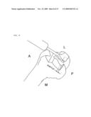 Method and system for cutting knee joint using robot diagram and image