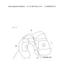 Method and system for cutting knee joint using robot diagram and image