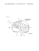 Method and system for cutting knee joint using robot diagram and image