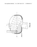 Method and system for cutting knee joint using robot diagram and image