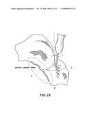 Method and system for cutting knee joint using robot diagram and image