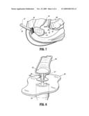 ANASTOMOSIS COMPOSITE GASKET diagram and image