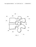 SPINAL STABILIZATION SYSTEM diagram and image
