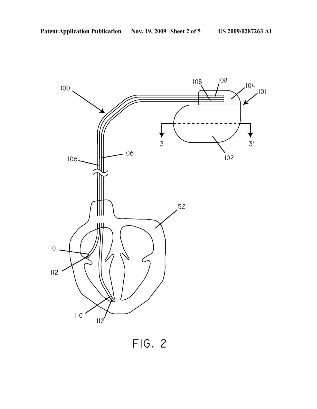 MEDICAL DEVICE WITH LIQUID FILLED HOUSING - diagram, schematic, and image 03