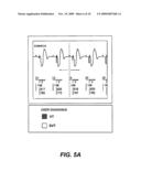 METHODS AND SYSTEMS FOR IMPROVED ARRHYTHMIA DISCRIMINATION diagram and image