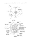 PHYSIOLOGICALLY HARMONIZED TRICUSPID ANNULOPLASTY RING diagram and image