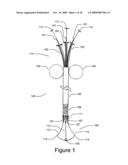 Medical Device for Constricting Tissue or a Bodily Orifice, for example a mitral valve diagram and image