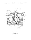 Medical Device for Constricting Tissue or a Bodily Orifice, for example a mitral valve diagram and image