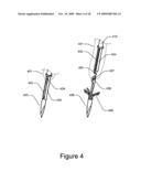 Medical Device for Constricting Tissue or a Bodily Orifice, for example a mitral valve diagram and image