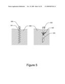 Medical Device for Constricting Tissue or a Bodily Orifice, for example a mitral valve diagram and image