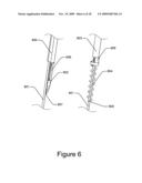 Medical Device for Constricting Tissue or a Bodily Orifice, for example a mitral valve diagram and image