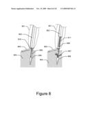 Medical Device for Constricting Tissue or a Bodily Orifice, for example a mitral valve diagram and image