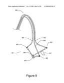 Medical Device for Constricting Tissue or a Bodily Orifice, for example a mitral valve diagram and image