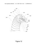 Medical Device for Constricting Tissue or a Bodily Orifice, for example a mitral valve diagram and image