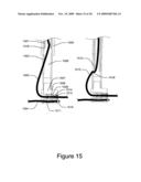 Medical Device for Constricting Tissue or a Bodily Orifice, for example a mitral valve diagram and image