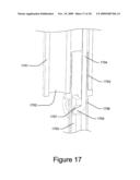 Medical Device for Constricting Tissue or a Bodily Orifice, for example a mitral valve diagram and image