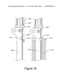 Medical Device for Constricting Tissue or a Bodily Orifice, for example a mitral valve diagram and image