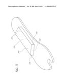 FOOT PROSTHESIS WITH RESILIENT MULTI-AXIAL ANKLE diagram and image