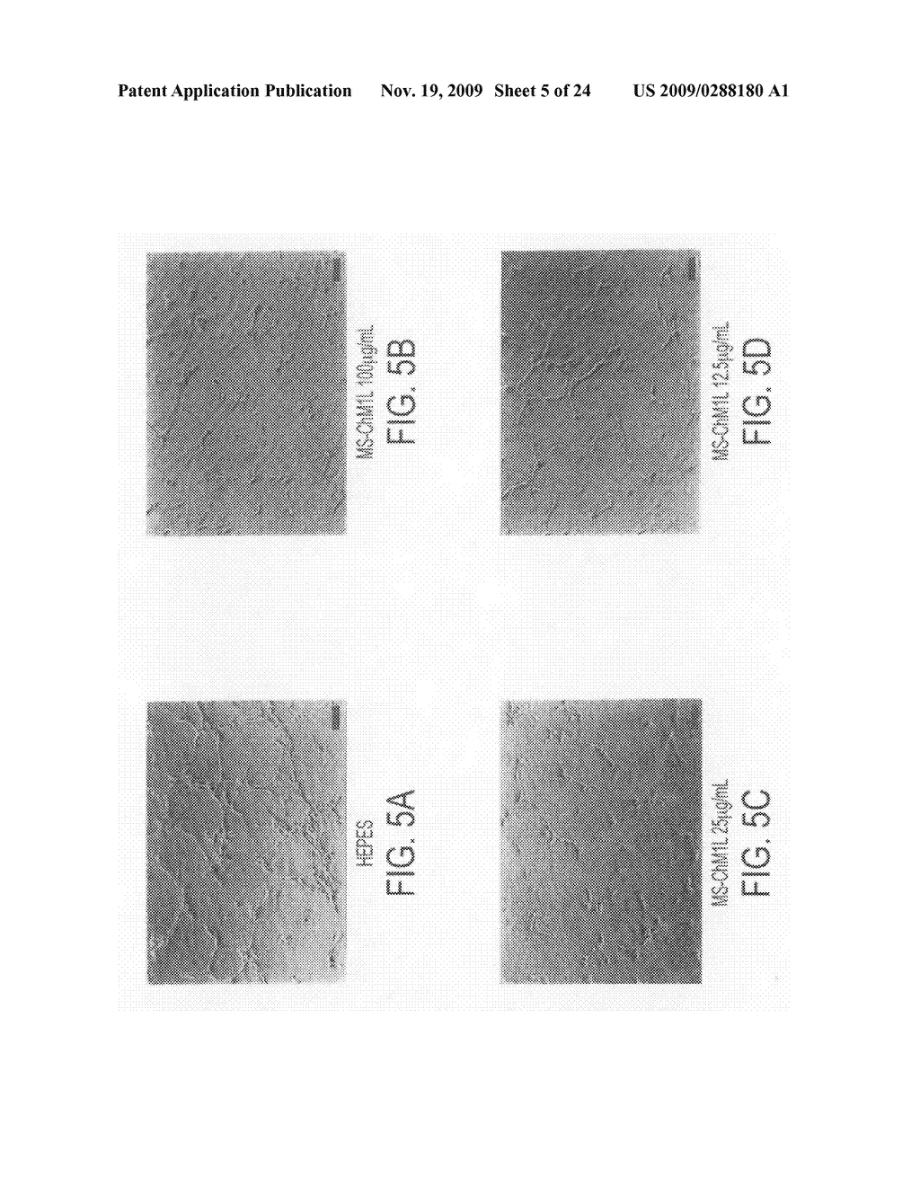 NOVEL PROTEIN AND PRODUCTION PROCESS AND USE THEREOF - diagram, schematic, and image 06