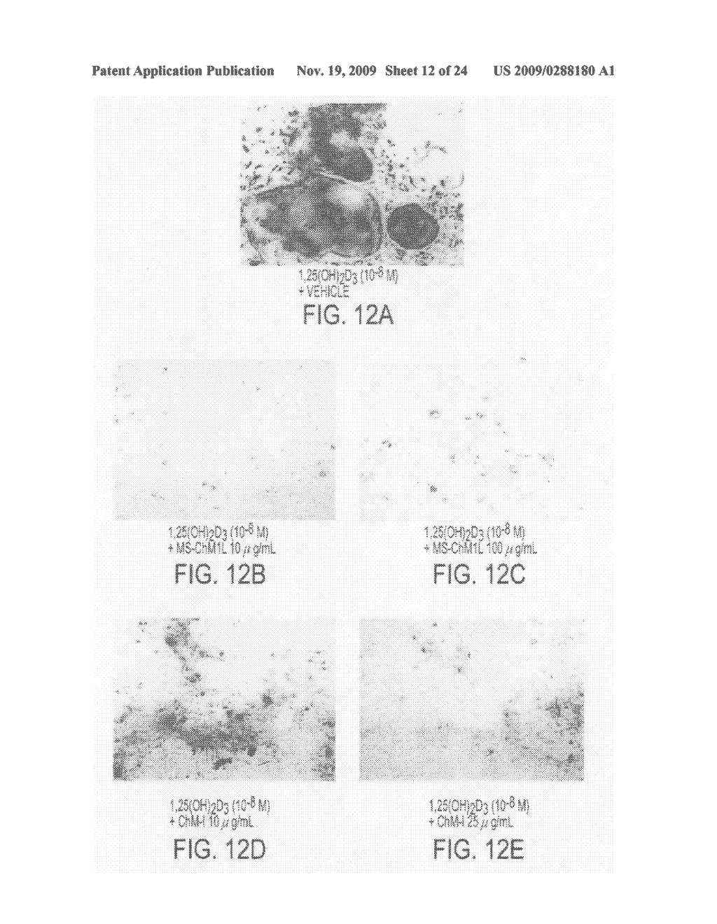 NOVEL PROTEIN AND PRODUCTION PROCESS AND USE THEREOF - diagram, schematic, and image 13