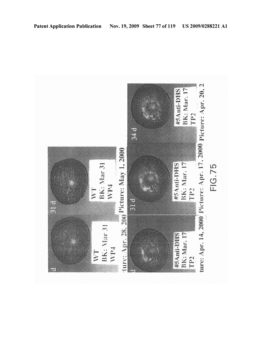 Polynucleotides Encoding Canola DHS and Antisense Polynucleotides Thereof - diagram, schematic, and image 78