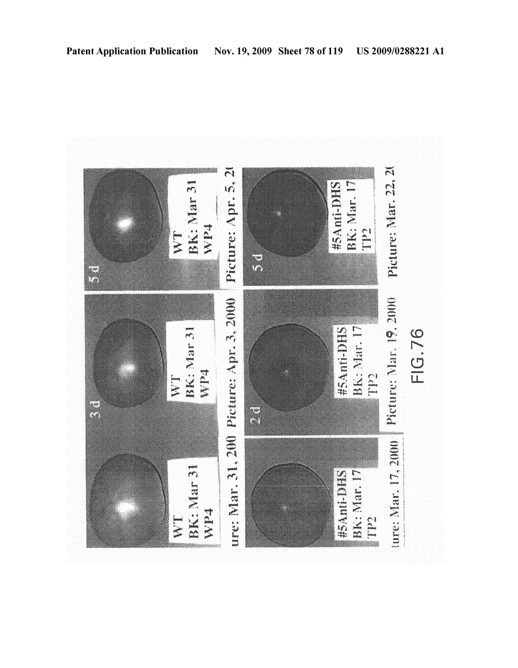 Polynucleotides Encoding Canola DHS and Antisense Polynucleotides Thereof - diagram, schematic, and image 79