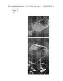 Improvements in or Relating to Starch Storage in Plants diagram and image