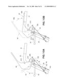 TRANSMISSION diagram and image