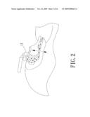 NEGATIVE-PRESSURE ORAL APPARATUS AND METHOD FOR MAINTAINING NEGATIVE ORAL PRESSURE AND COLLECTING LIQUID diagram and image