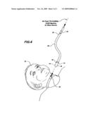 Infant Positive Pressure Tracheal Device diagram and image