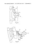 RAILWAY COUPLER CORE STRUCTURE FOR INCREASED STRENGTH AND FATIGUE LIFE OF RESULTING KNUCKLE diagram and image