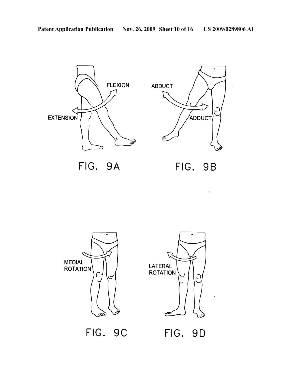 COMPUTER-GUIDED SYSTEM FOR ORIENTING THE ACETABULAR CUP IN THE PELVIS DURING TOTAL HIP REPLACEMENT SURGERY - diagram, schematic, and image 11