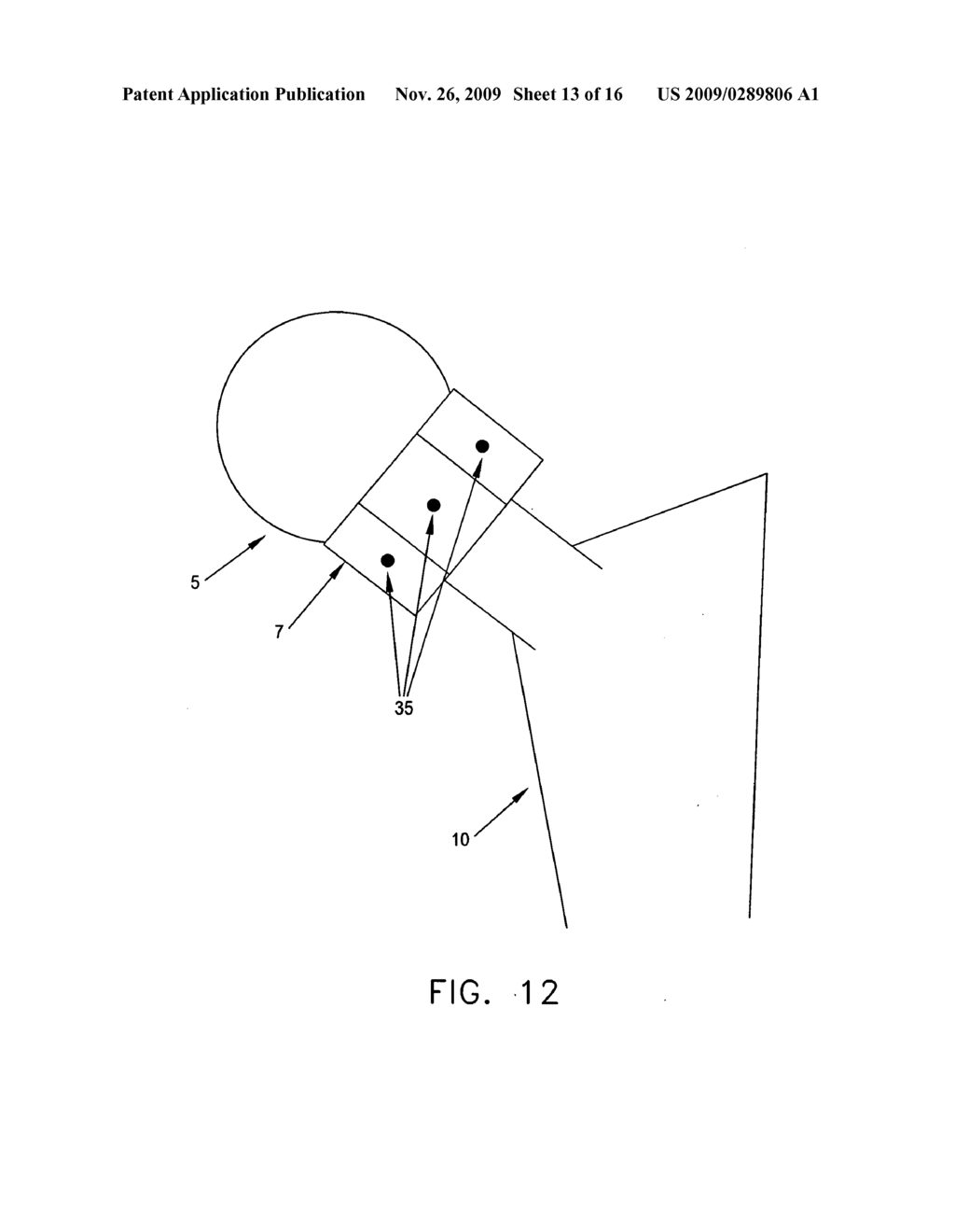 COMPUTER-GUIDED SYSTEM FOR ORIENTING THE ACETABULAR CUP IN THE PELVIS DURING TOTAL HIP REPLACEMENT SURGERY - diagram, schematic, and image 14