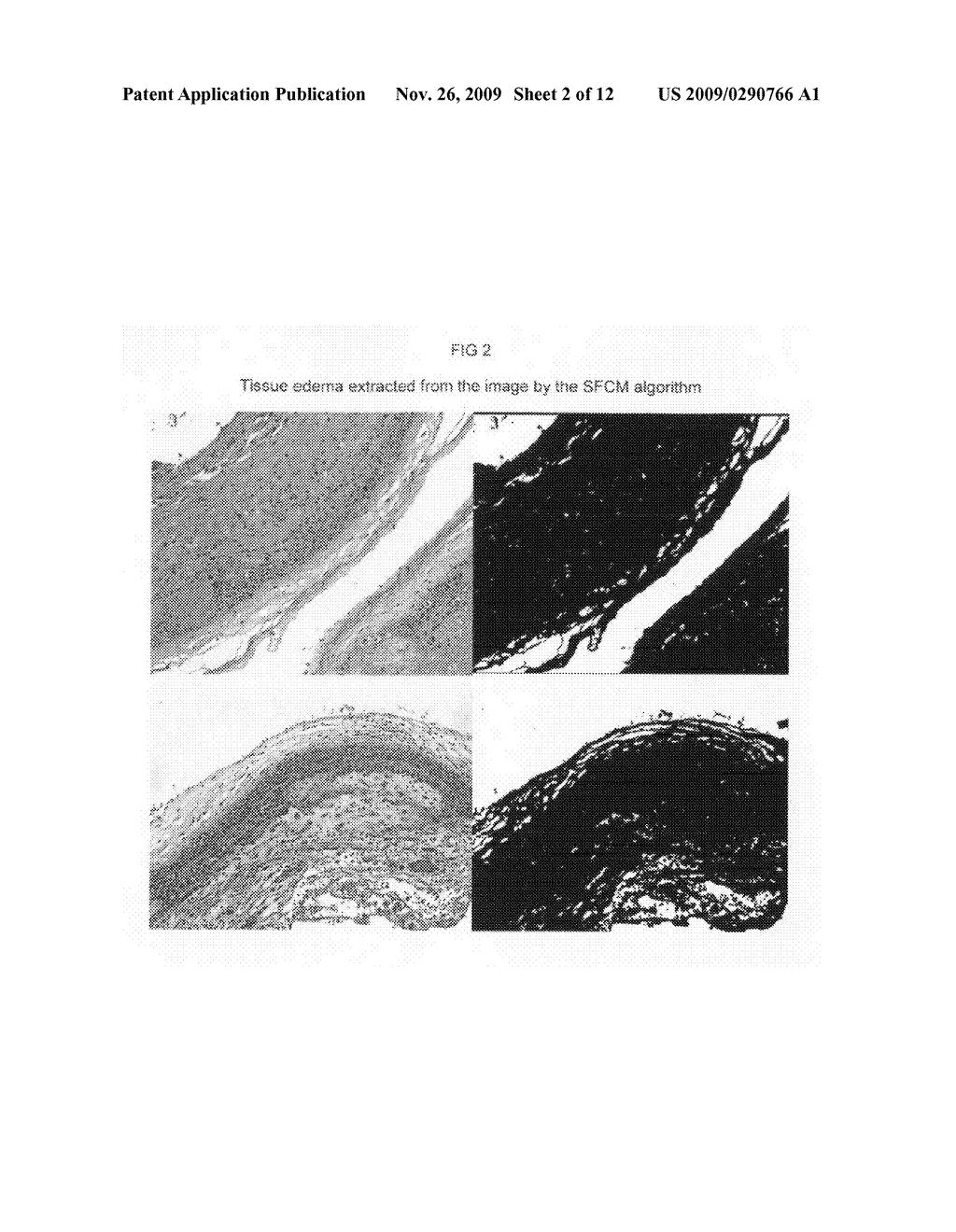 Automated placental measurement - diagram, schematic, and image 03