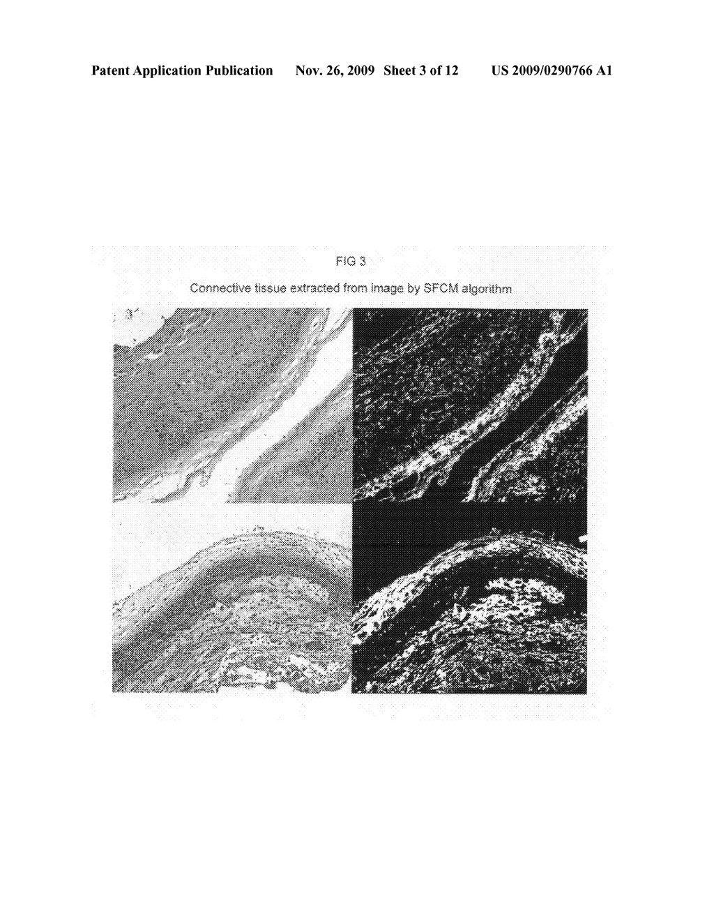 Automated placental measurement - diagram, schematic, and image 04