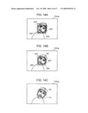 Detection of Organ Area Corresponding to Facial Organ Image in Image diagram and image