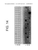 Antagonists of IL-6 to prevent or treat Thrombosis diagram and image