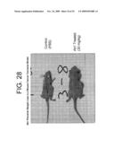 Antagonists of IL-6 to prevent or treat Thrombosis diagram and image