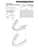 Dental implant positioning diagram and image