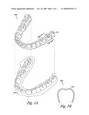 Dental implant positioning diagram and image