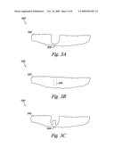 Dental implant positioning diagram and image